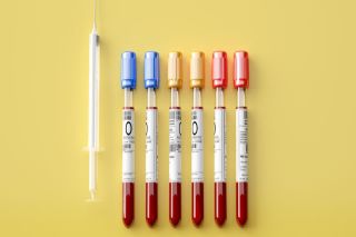 醉驾血液样本保存要求的规定是什么 醉驾血液样本保存有什么规定